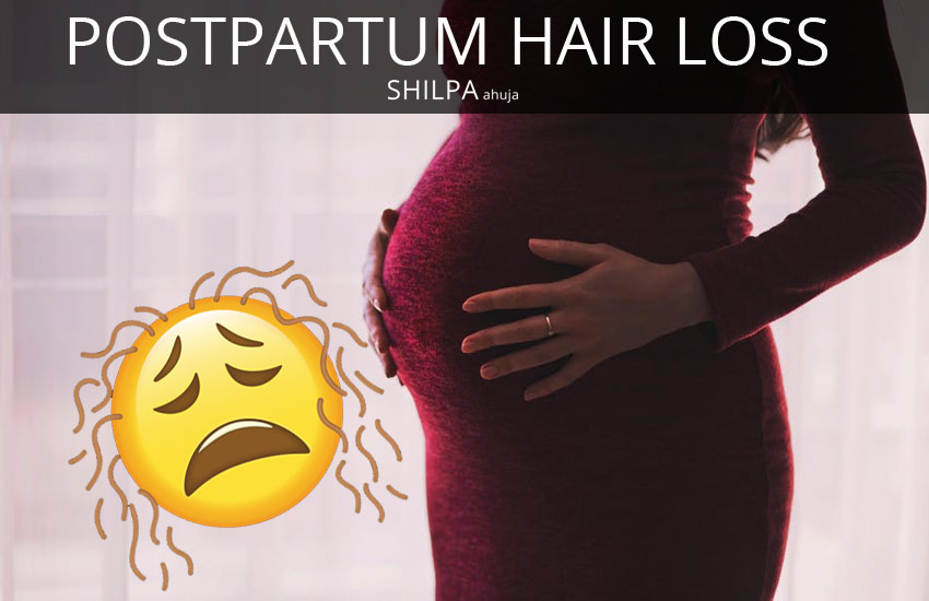 Postpartum Hair Loss Post Pregnancy Hair Regrowth