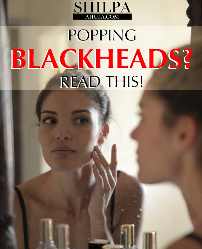 Popping-Blackheads-Your-Safe-and-Effective-Guide-